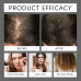 Deoxyribose Sugar Gel Hair Growth Serum, 60ml Hair Thickening Natural Ingredients